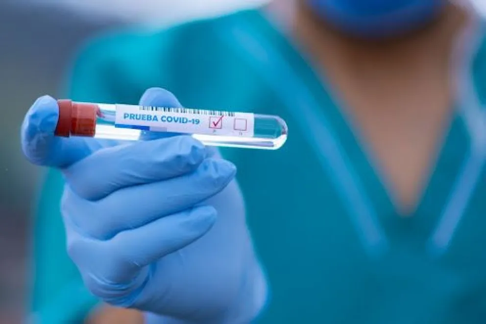 En la provincia hubo 161 nuevos casos y 3 muertes por Coronavirus