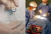 Dos jóvenes villamercedinos recibieron implantes que les permitirán recuperar la audición